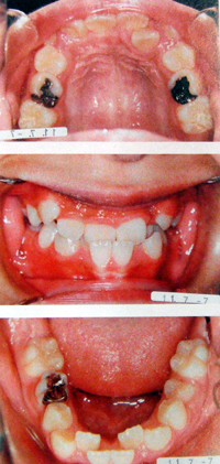 �q���̊{���g���鋸�����u�E�g�勸���O